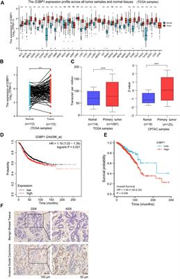 G3BP1 regulates breast cancer cell proliferation and metastasis by modulating PKCζ